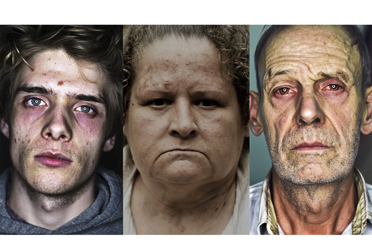 Изображение из трех частей - трех людей с признаками алкоголизма